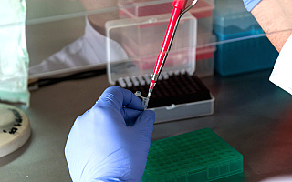 Sanepid potwierdził kolejne zakażenie odrą. Chorych może być jeszcze więcej Sanepid potwierdził kolejne zakażenie odrą. Chorych może być jeszcze więcej